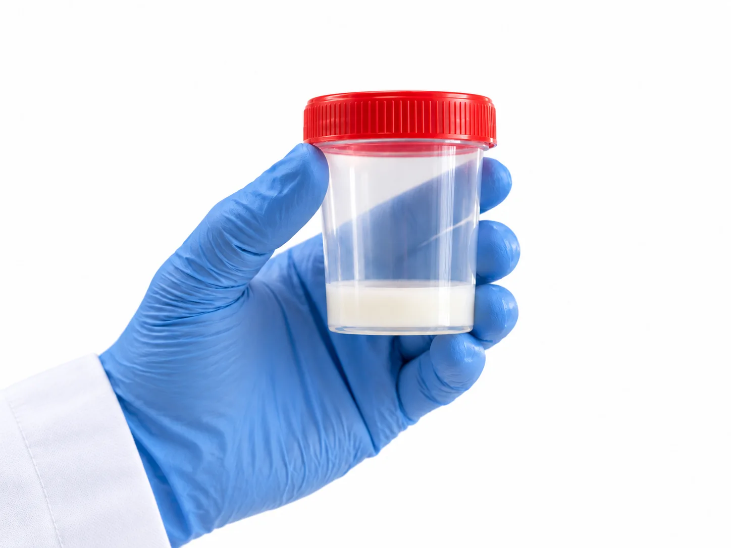 Instalaciones de CEMPI para semen de donante